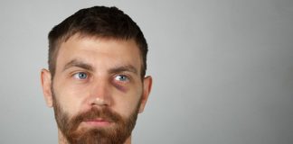 Günümüzde erkeklerin kişisel bakım alışkanlıkları giderek çeşitlenirken, cilt sağlığına yönelik çözümler de daha fazla önem kazanıyor. Özellikle göz altı morlukları, yorgun görünüm oluşturan ve birçok erkeğin karşılaştığı yaygın cilt problemleri arasında yer alıyor. Yoğun iş temposu, düzensiz uyku, stres, çevresel faktörler ve yaşam alışkanlıkları göz çevresindeki hassas bölgenin görünümünü doğrudan etkileyebiliyor. Konulu bir haber görseli.