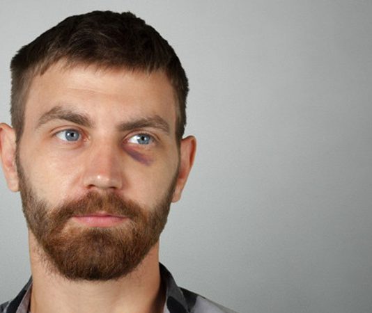 Erkek Göz Altı Morluklarına Karşı Çözümler Günümüzde erkeklerin kişisel bakım alışkanlıkları giderek çeşitlenirken, cilt sağlığına yönelik çözümler de daha fazla önem kazanıyor. Özellikle göz altı morlukları, yorgun görünüm oluşturan ve birçok erkeğin karşılaştığı yaygın cilt problemleri arasında yer alıyor. Yoğun iş temposu, düzensiz uyku, stres, çevresel faktörler ve yaşam alışkanlıkları göz çevresindeki hassas bölgenin görünümünü doğrudan etkileyebiliyor. Konulu bir haber görseli.