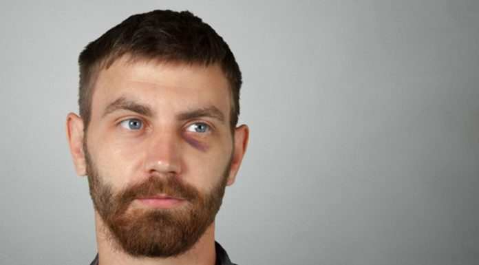 Erkeklerin Göz Altı Morluklarına Karşı Çözümler Günümüzde erkeklerin kişisel bakım alışkanlıkları giderek çeşitlenirken, cilt sağlığına yönelik çözümler de daha fazla önem kazanıyor. Özellikle göz altı morlukları, yorgun görünüm oluşturan ve birçok erkeğin karşılaştığı yaygın cilt problemleri arasında yer alıyor. Yoğun iş temposu, düzensiz uyku, stres, çevresel faktörler ve yaşam alışkanlıkları göz çevresindeki hassas bölgenin görünümünü doğrudan etkileyebiliyor. Konulu bir haber görseli.